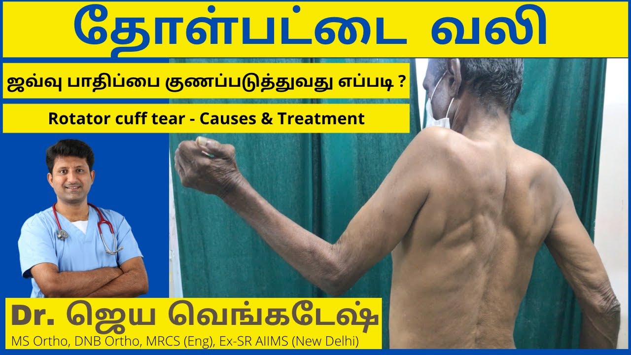 தோள்பட்டை ஜவ்வு கிழிதலுக்கு முழுமையான தீர்வு - Rotator cuff tear treatment #shoulderpain #tamiltips