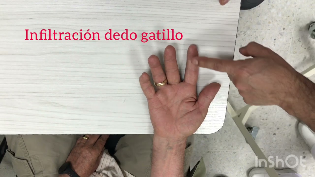 Infiltración Dedo Gatillo