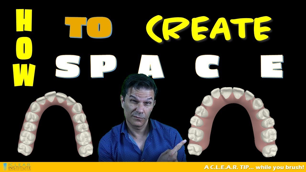 How to create space in clear aligners treatments - 5 ways to do it