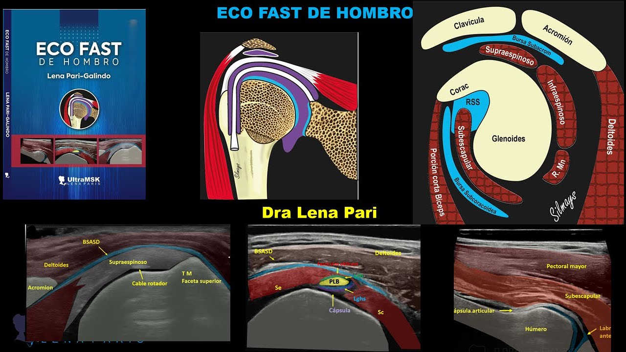 ¿Como aprender ecografía de hombro del básico al avanzado? Lee este libro Eco Fast de Hombro