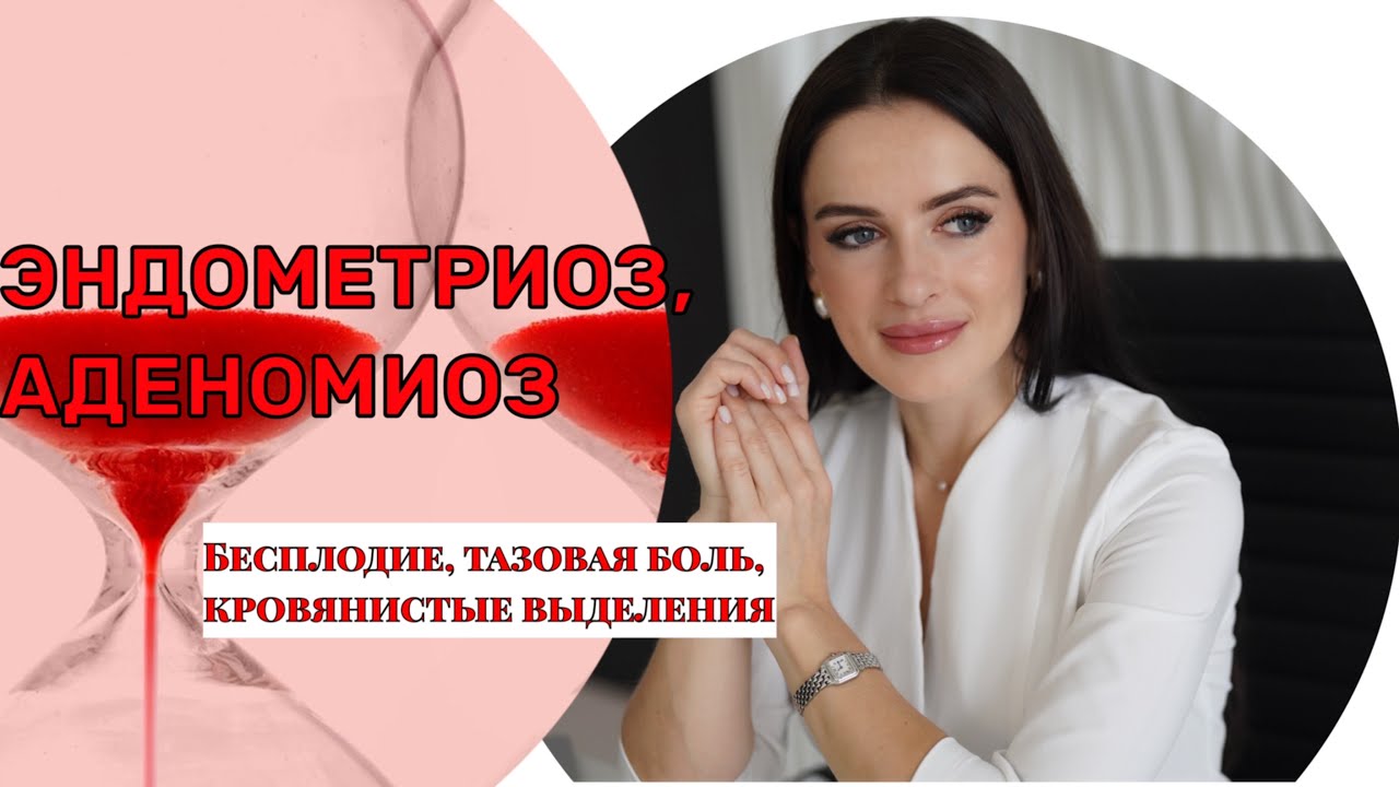 Эндометриоз, аденомиоз или диффузные изменения в миометрии, что это и как с этим жить?