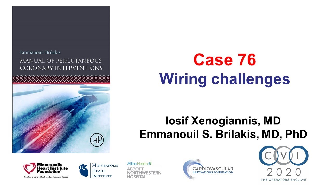 Case 76: PCI Manual - Wiring challenges