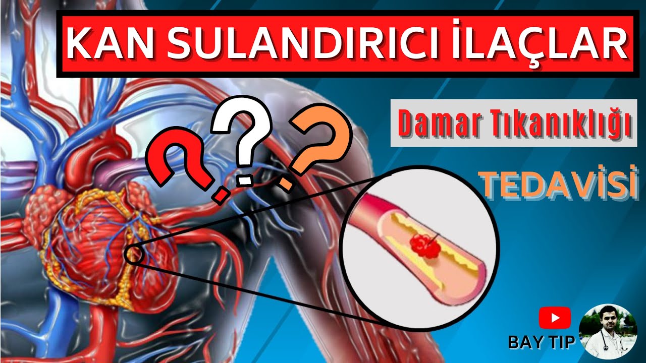 KAN SULANDIRICI İLAÇLAR NEDİR? DAMAR TIKANIKLIĞI TEDAVİSİ