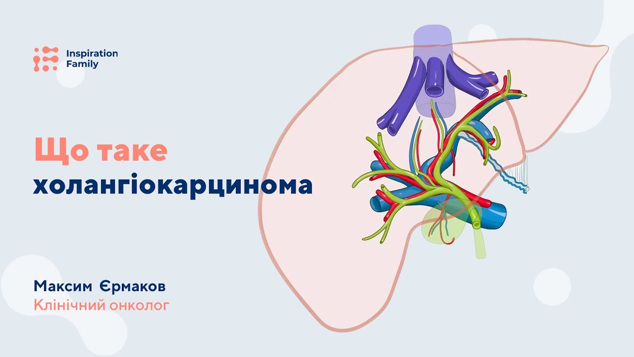 Що таке холангіокарцинома | Inspiration Family
