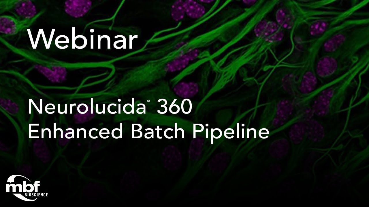 Webinar: Introducing Neurolucida 360’s Enhanced Batch Pipeline