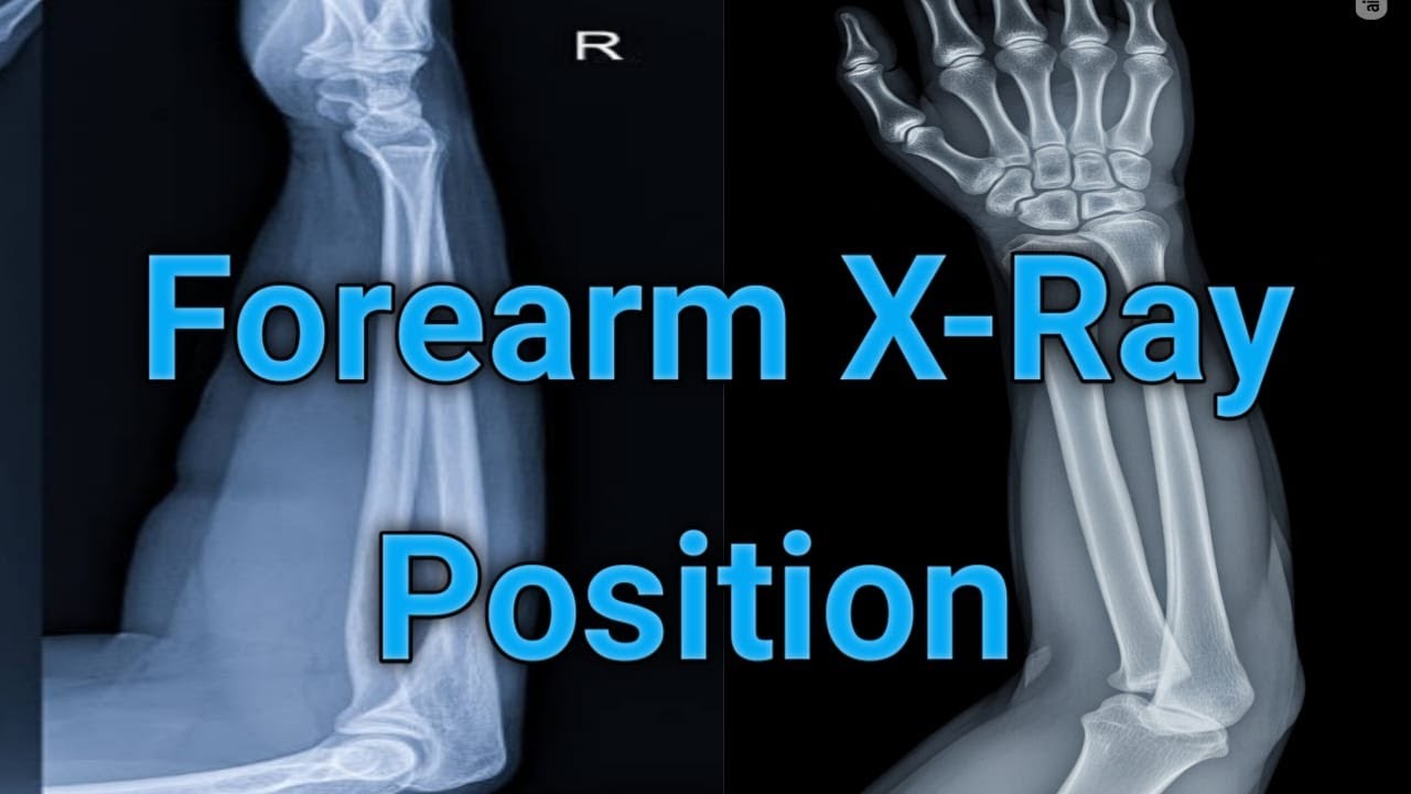 Forearm X-ray AP & Lateral 💪 | شرح وضعيات الساعد بالأشعة