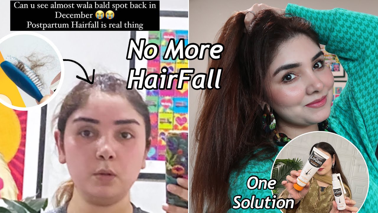 One Solution For Extreme HairFall || @nishookhan