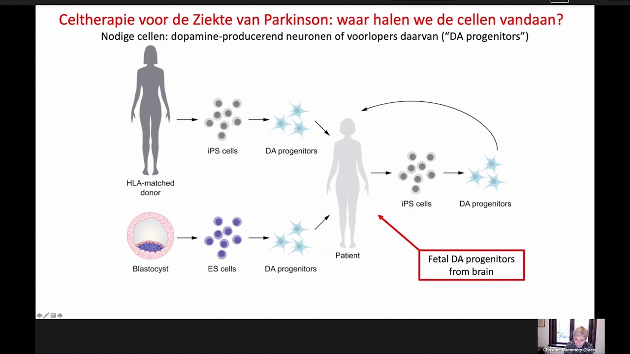 College 5: Stamcellen en celtherapie voor de ziekte van Parkinson