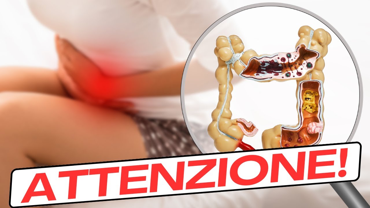Alimenti SALVA intestino (e perché è pericoloso farne a meno)