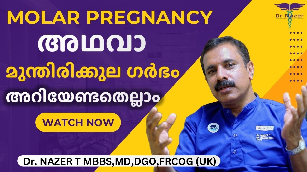 MOLAR PREGNANCY | മുന്തിരിക്കുല ഗർഭം അറിയേണ്ടതെല്ലാം | MALAYALAM | Dr NAZER