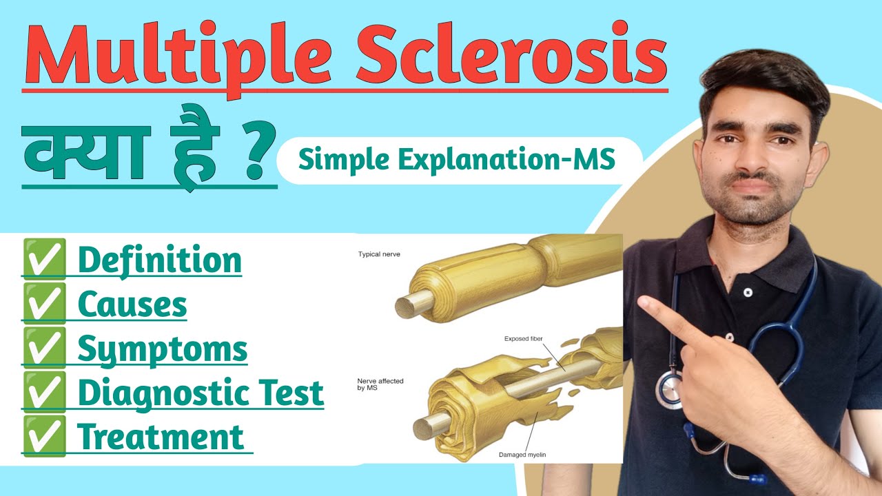 Multiple Sclerosis in Hindi | Causes, Symptoms And Treatment of Multiple Sclerosis