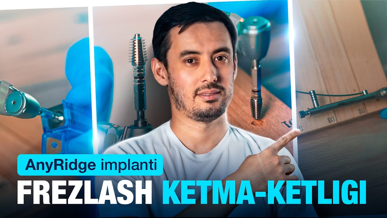 Mega'Gen innovatsiyasi | AnyRidge implantlari haqida to‘liq ma'lumot