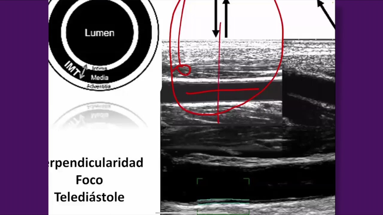 Clase 2 - Update Doppler Vascular.