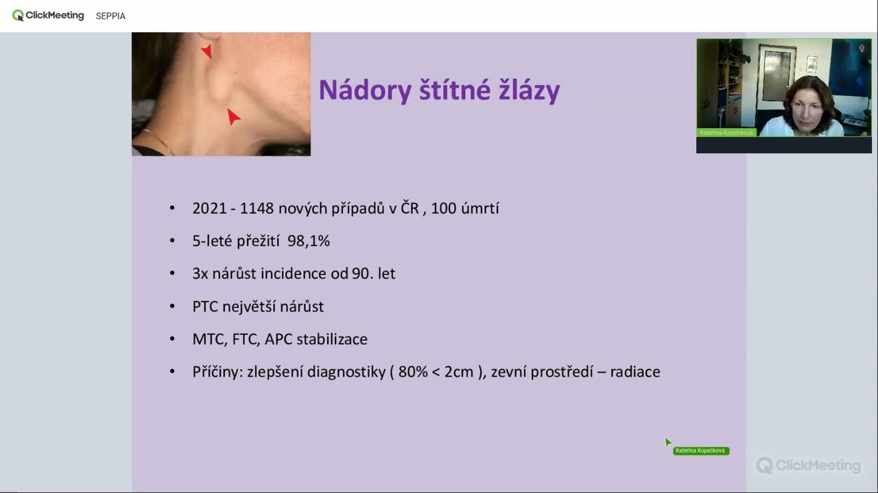 Nežádoucí účinky při léčbě radiojod-refrakterních nádorů štítné žlázy, Doc. MUDr. K Kopečková, Ph.D.