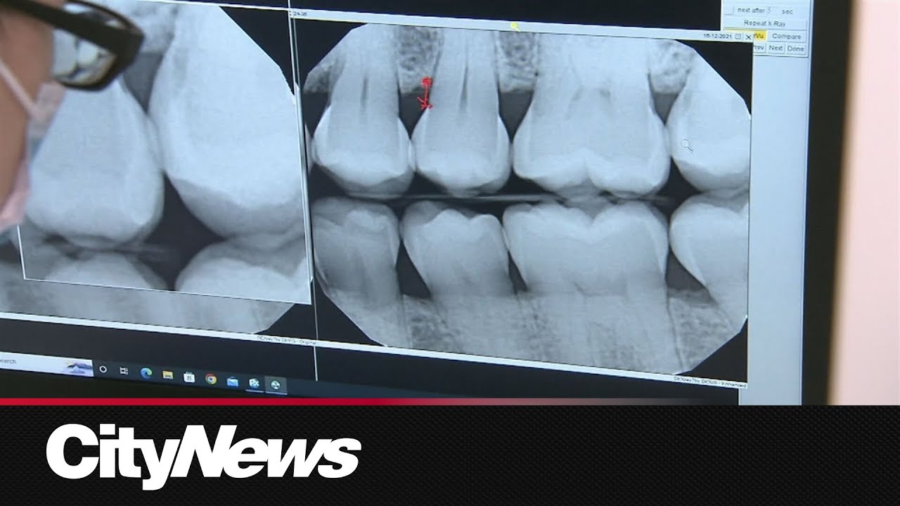 Dental Care Plan still going through growing pains