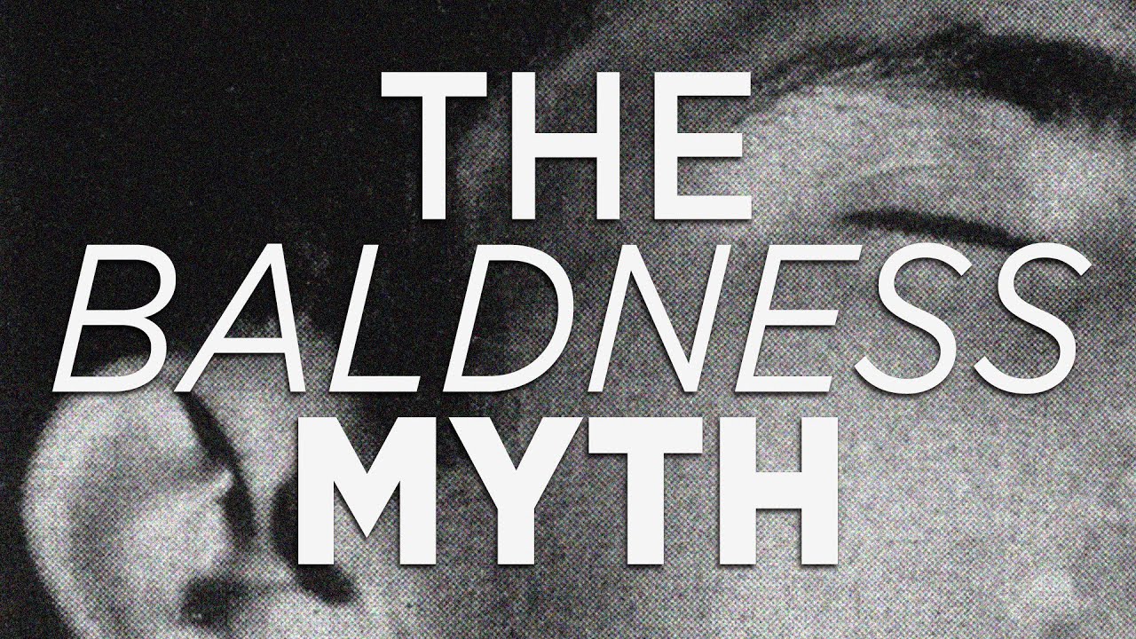 [1/4]  The Male Pattern Baldness Myth - The Genetic-Androgen Hypothesis