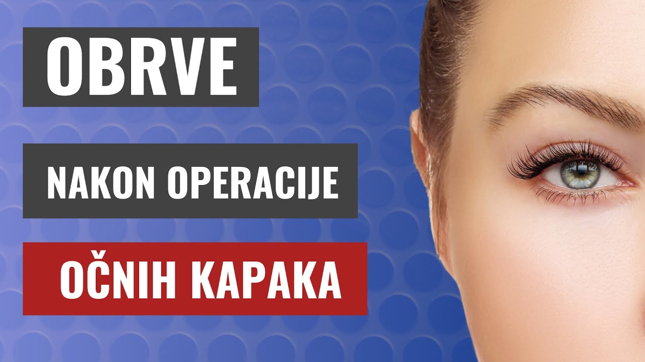 Obrve nakon blefatoplastike