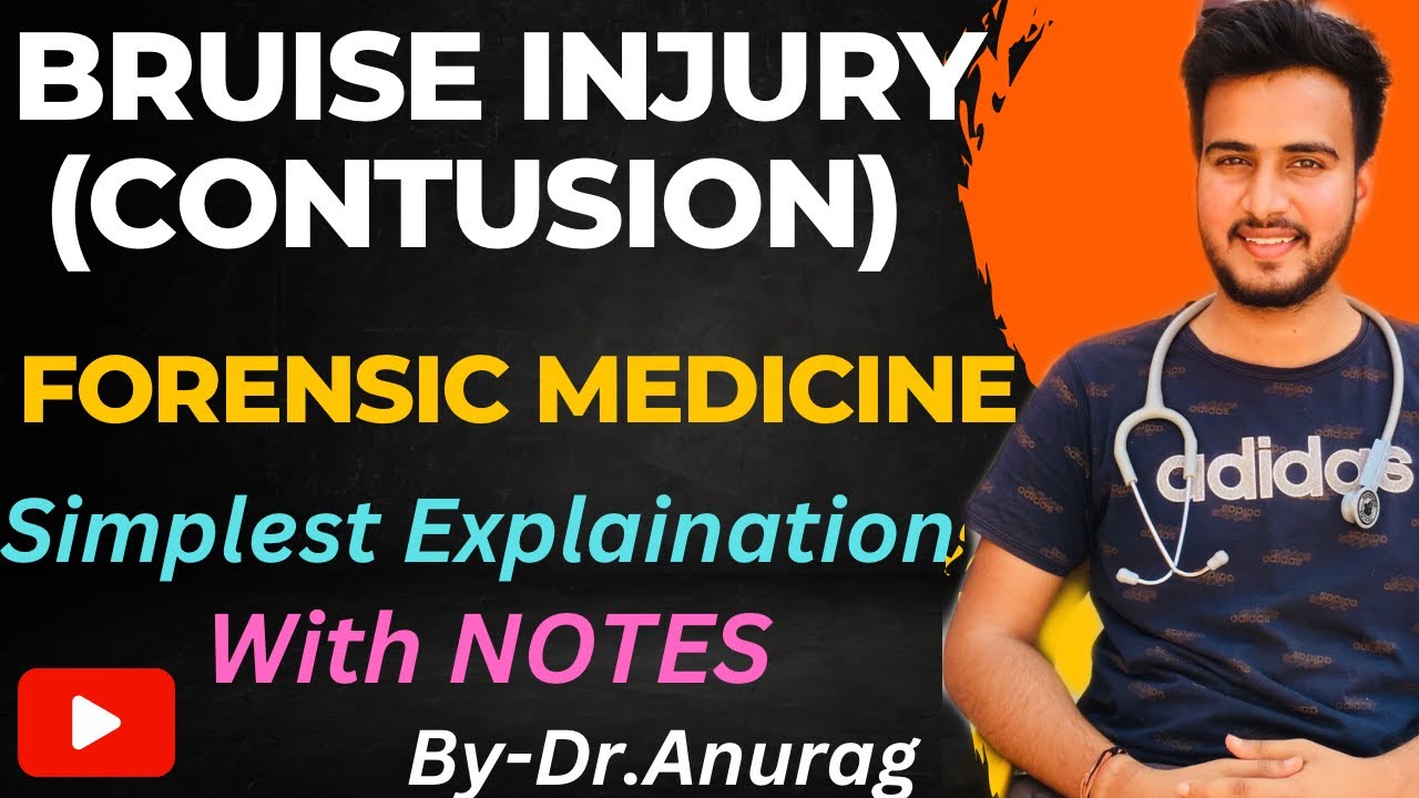 Bruise injury//Contusion injury in Hindi//Bruise in forensic medicine @AnuragSainiMBBS
