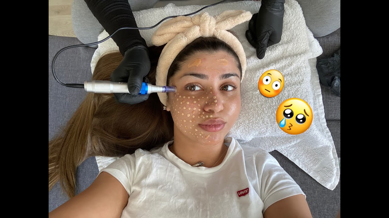 جهاز BB-GLOW | النتيجة 😱