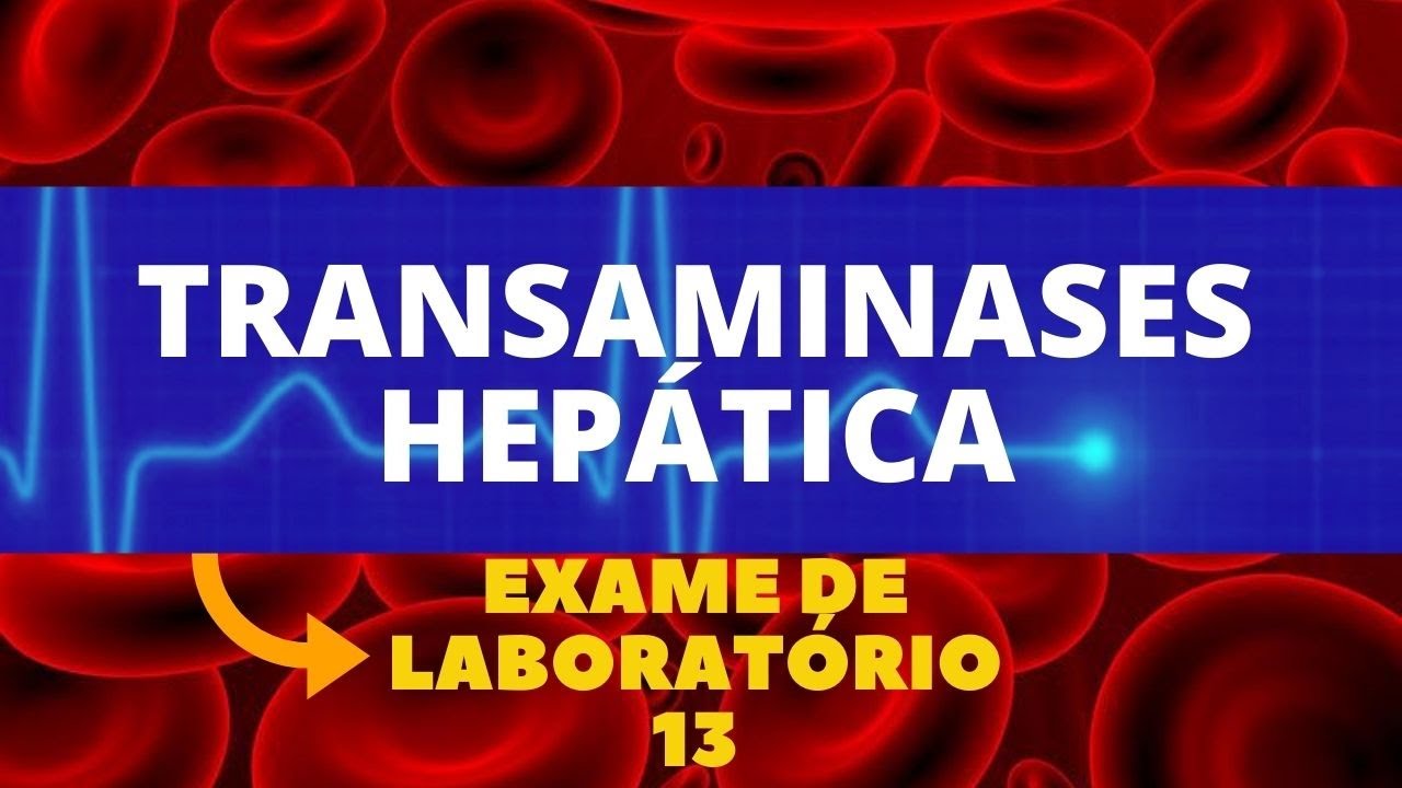 TRANSAMINASES HEP&Aacute;TICA - TGO-TGP E ALT-AST - (DETECTAM PROBLEMAS NO F&Iacute;GADO)