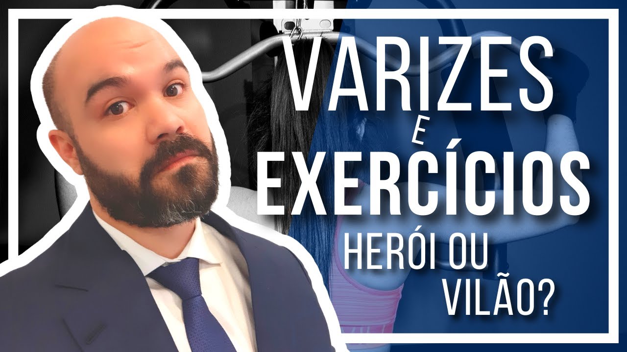 🔴 Exercícios pioram as Varizes? [DEFINITIVO]