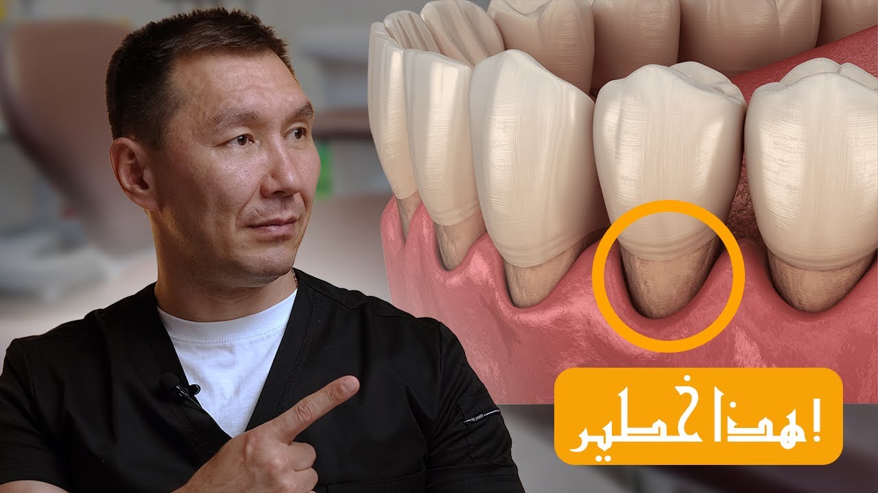 هل جذور أسنانك مكشوفة؟ إليك ما يجب عليك فعله عندما تتراجع اللثة!
