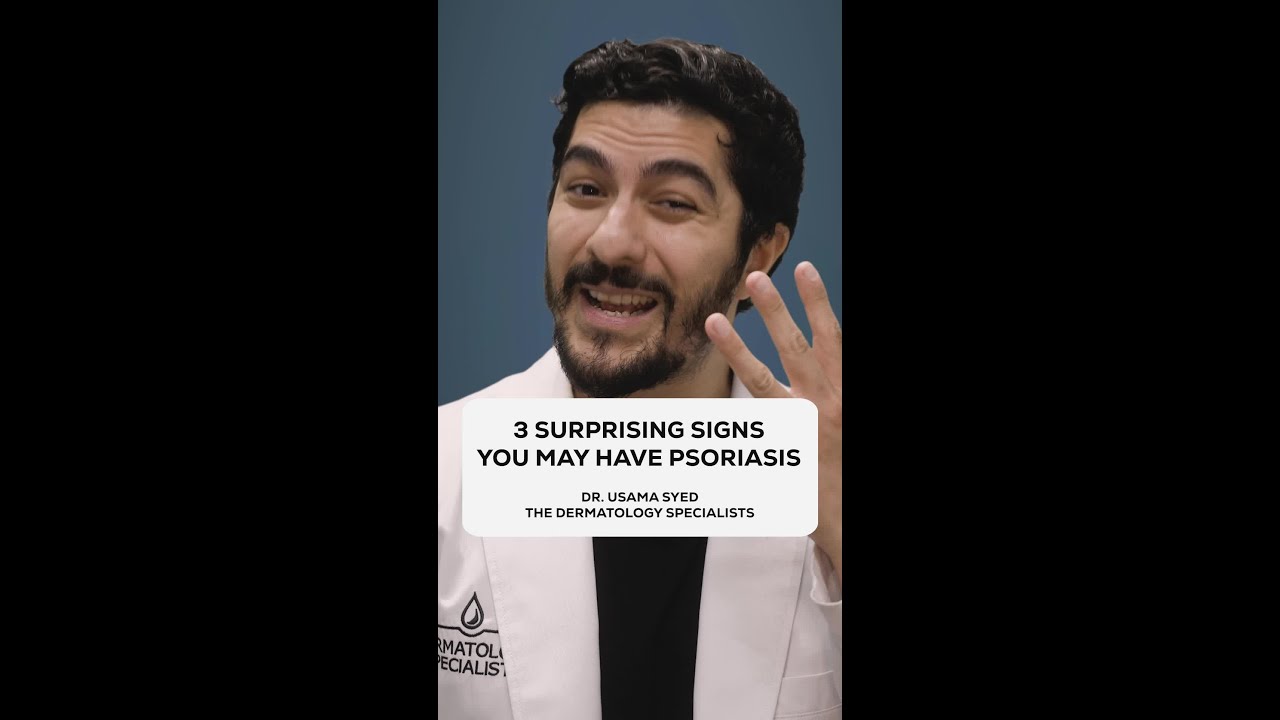 3 Surprising signs you may have Psoriasis