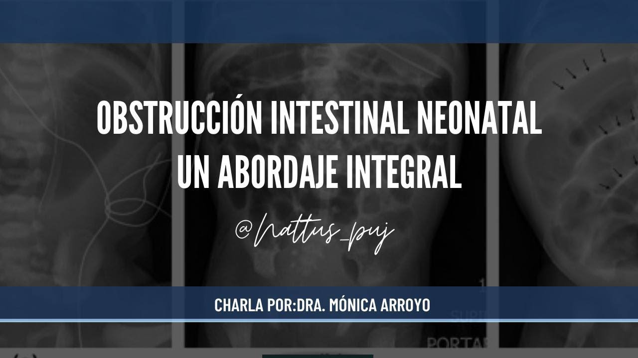 Abordaje obstrucción intestinal en el recién nacido