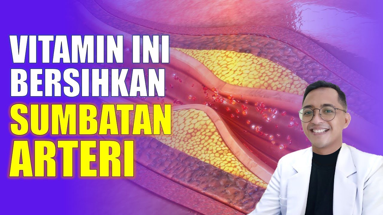 Pembuluh Darah Tersumbat? Atasi dengan Vitamin Ini!