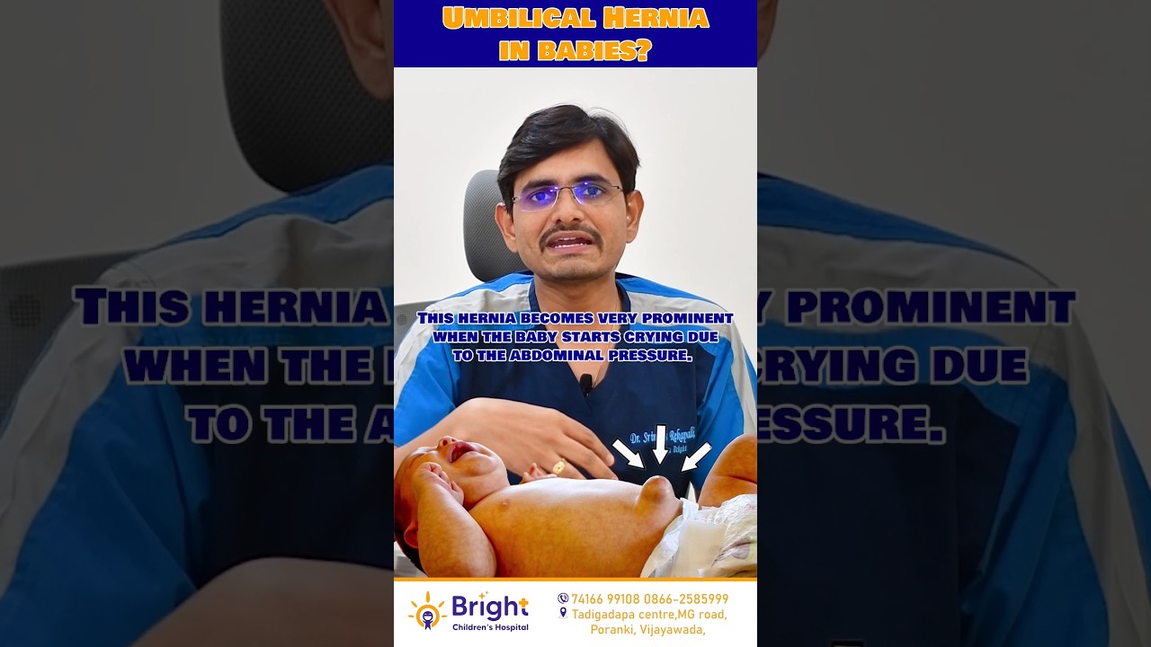 What is Umbilical hernia in a baby? should we worry? when to go to hospital? #bright #umbilical