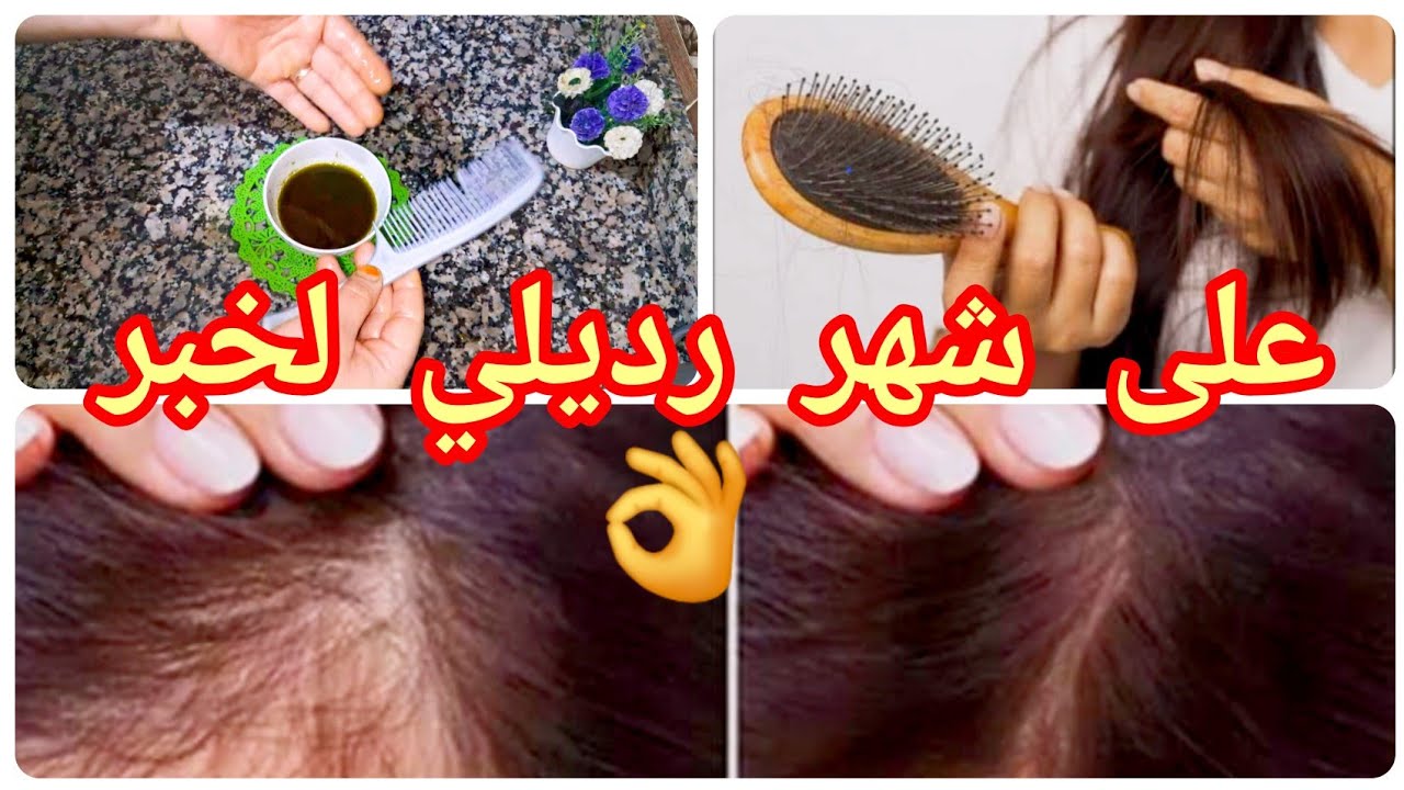 #من اليوم👇 قولى وداعأ #لتساقط_ الشعر # لقشرة_ الشعر #الزيت العجيبة_لي تهنيك من عداب سنوات#