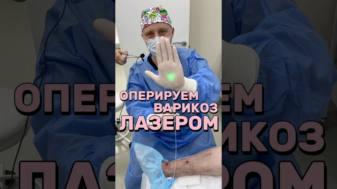 Оперируем варикоз лазером. Язва в ноге исчезнет #варикоз #лазер #язва