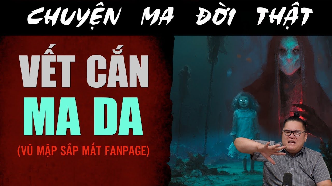[TẬP 2118] Chuyện Ma Có Thật : VẾT CẮN MA DA (VŨ MẬP SẮP MẤT FANPAGE)