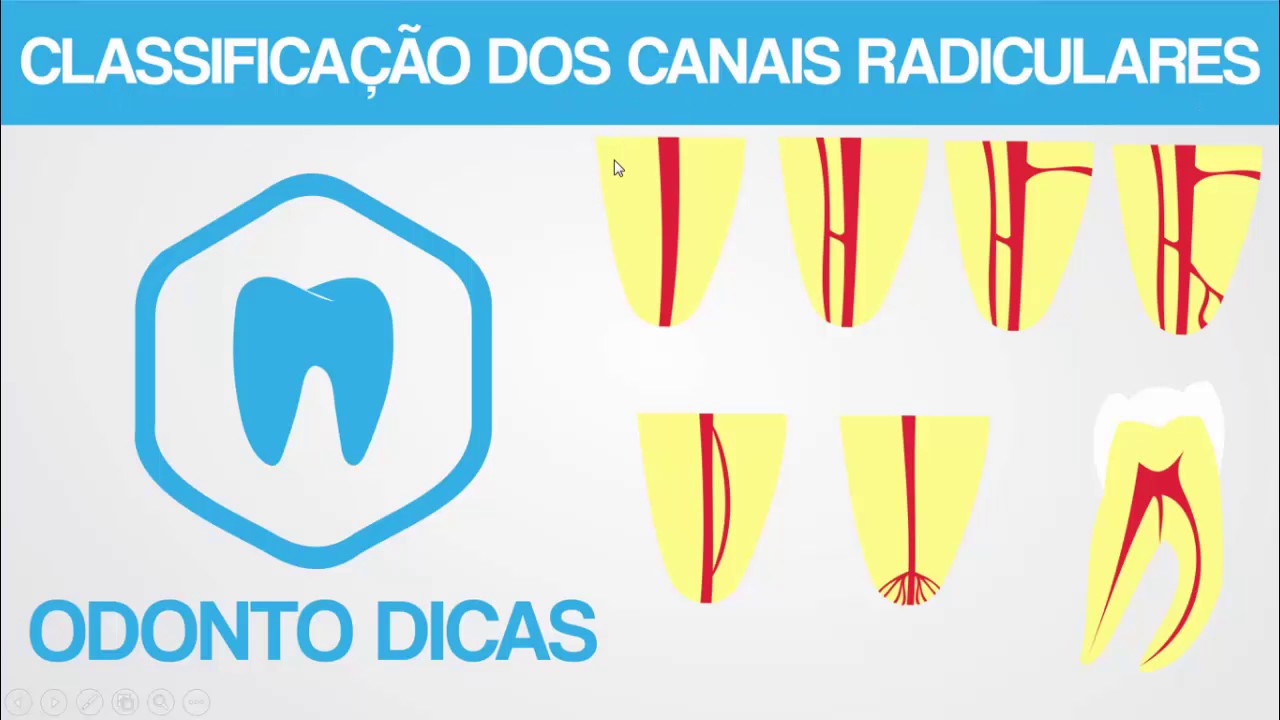 CLASSIFICAÇÃO DOS CANAIS RADICULARES | ODONTO DICAS