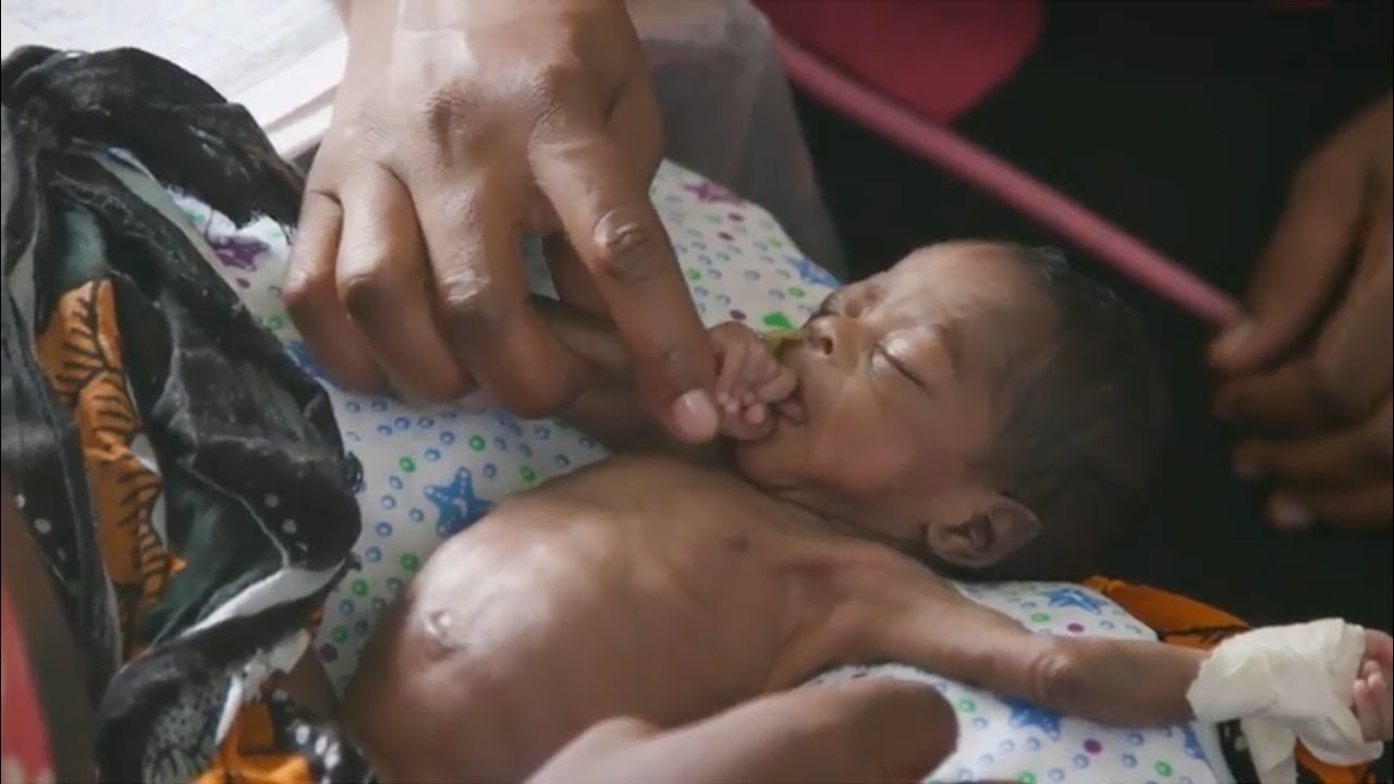 The UCSF East Africa Preterm Birth Initiative