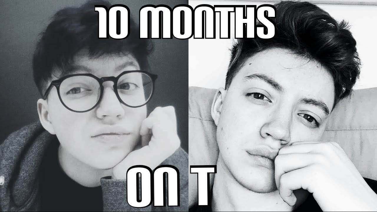 10 Months on Testosterone // FTM TRANSMAN