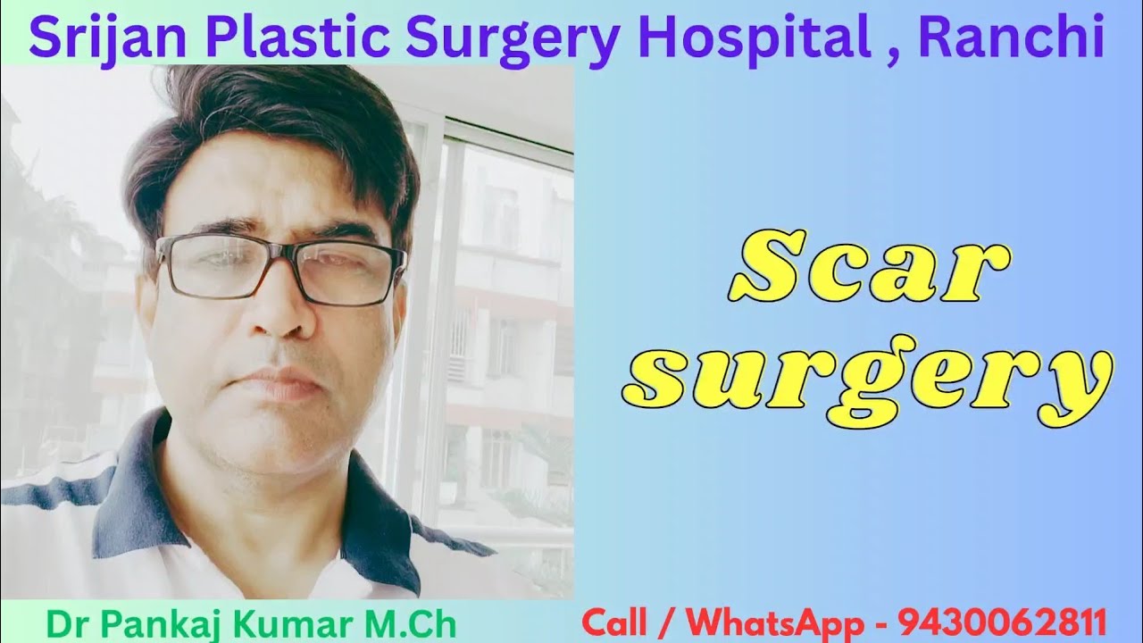 Scar revision surgery - 2:yr follow up result| Maharashtra to Ranchi for scar revision surgery #scar