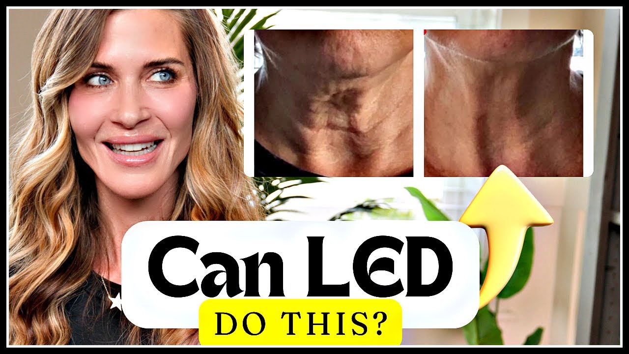 EXPERT Guide to LED: Melasma,  Eye Health, Fat Loss...What LED can and can't do 🤩 with Bev Sanderson