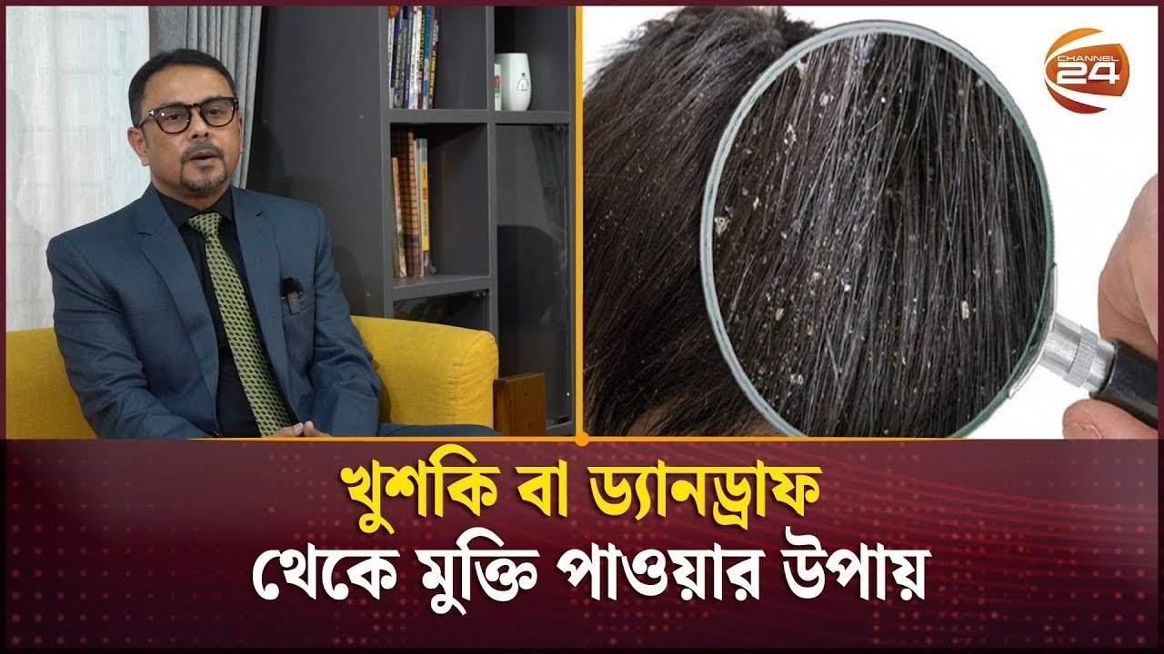 খুশকি বা ড্যানড্রাফ থেকে মুক্তি পাওয়ার উপায় | Dandruff | Channel 24