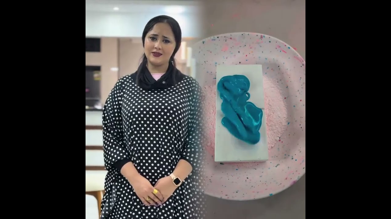 🤣A fun compilation,don't miss it!! #pov #skit #funny #story#fyp #foryou #fyp シ #fypage  #viral😜😜😜🤣🤣🤣