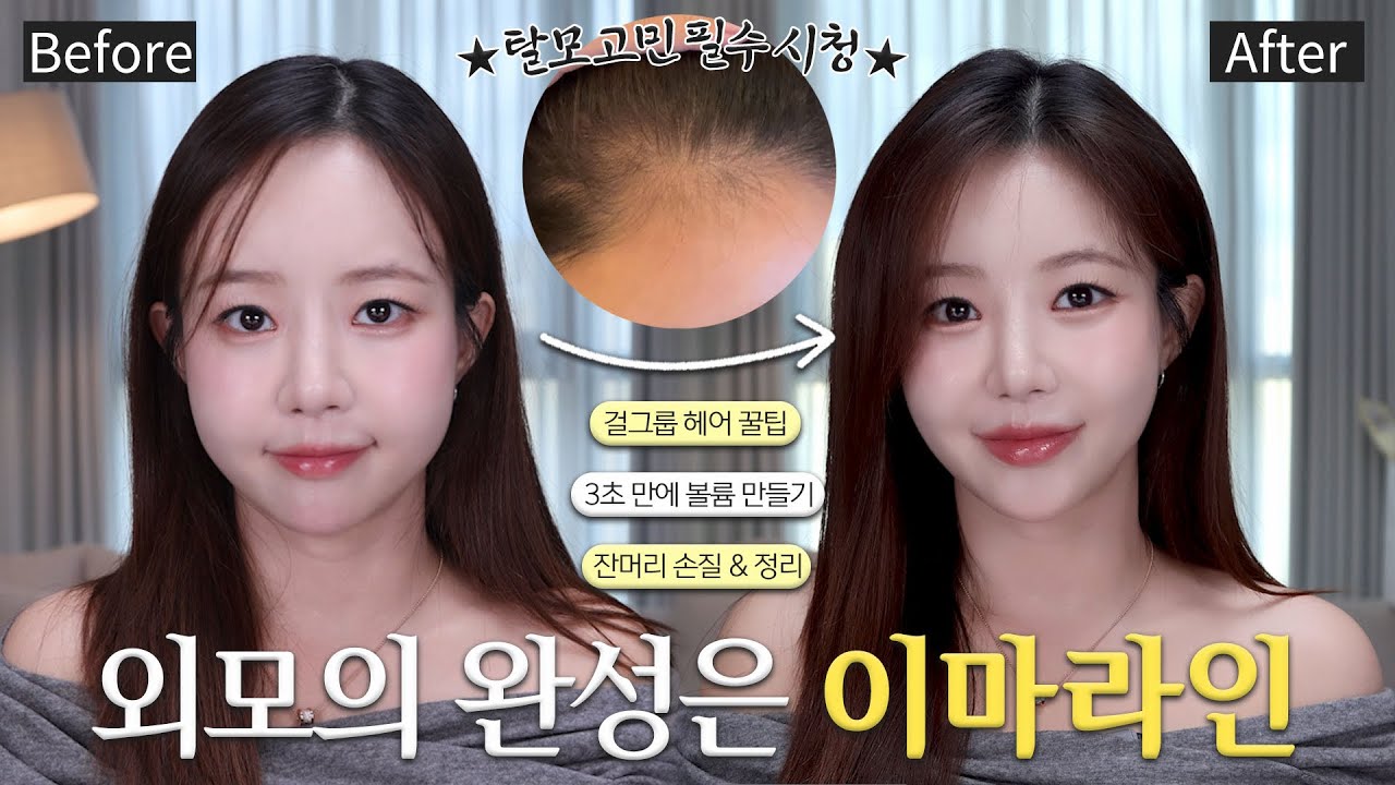 요즘 리즈맞아요! 외모는 이마라인이 완성한다 (헤어라인 과학적 분석 + 셀프 관리 팁) 셀프 컷트| M자 탈모