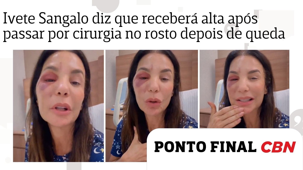 Ivete Sangalo diz que receberá alta após passar por cirurgia no rosto depois de queda