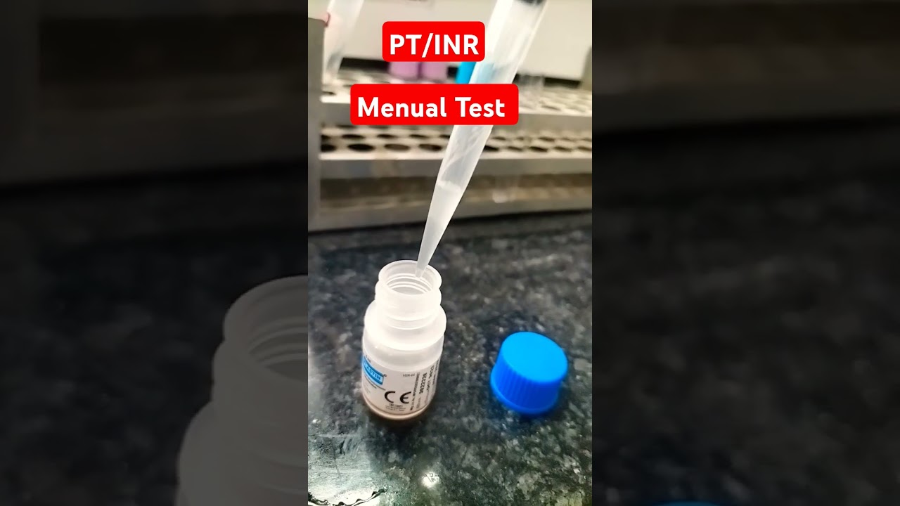 PT/INR menual Test #subscribe #complete #sudhirkumar #laboratory l#pathology #likeandsubscribe #