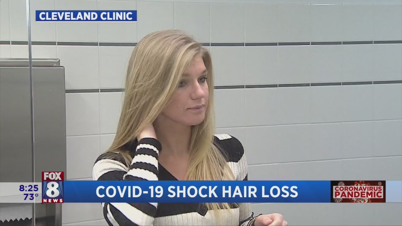 Shock hair loss -- It's real and it might explain what you are experiencing during the pandemic