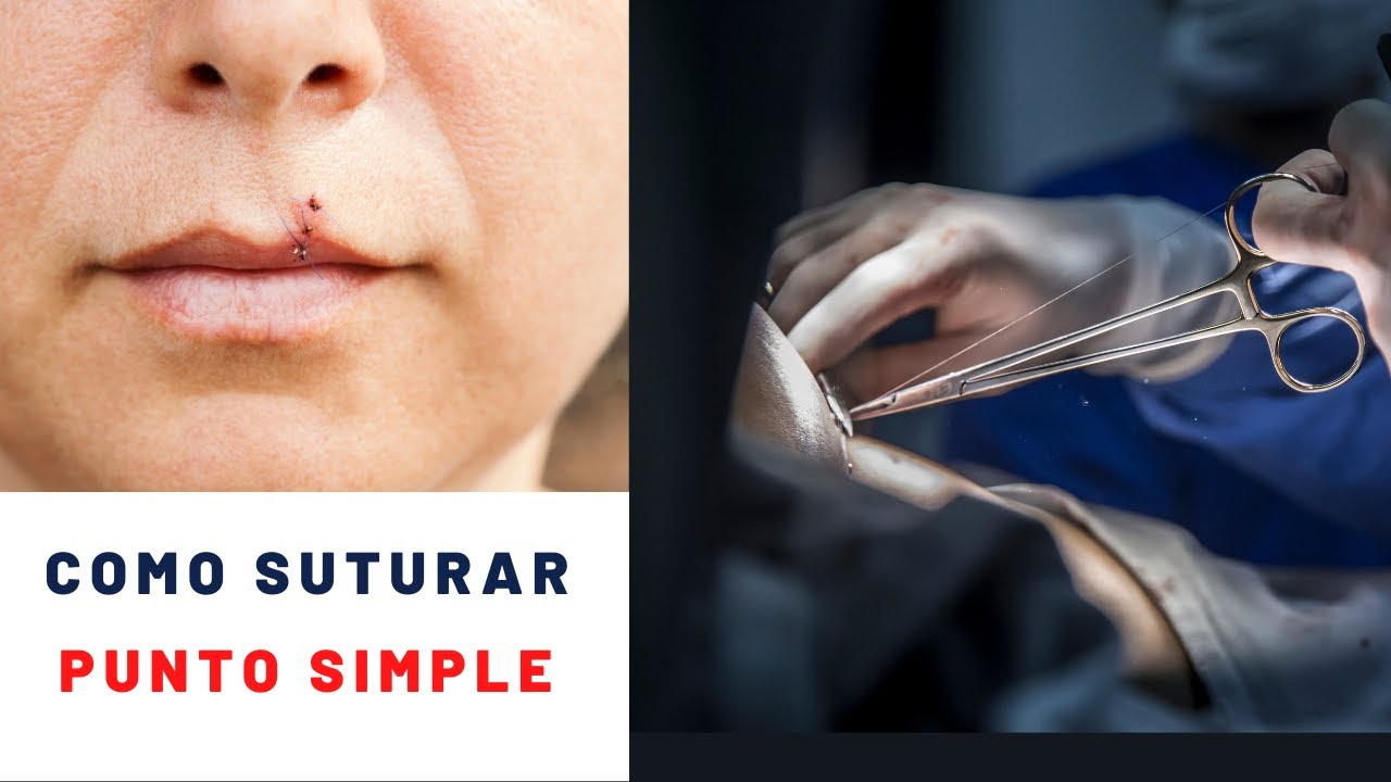 🔹 Como suturar un 𝗣𝗨𝗡𝗧𝗢 𝗦𝗜𝗠𝗣𝗟𝗘. 🩹 6 consejos!