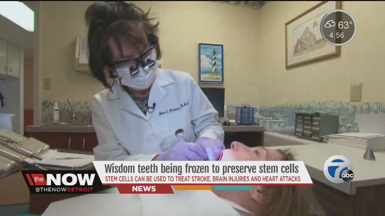 Wisdom teeth being frozen to preserve stem cells