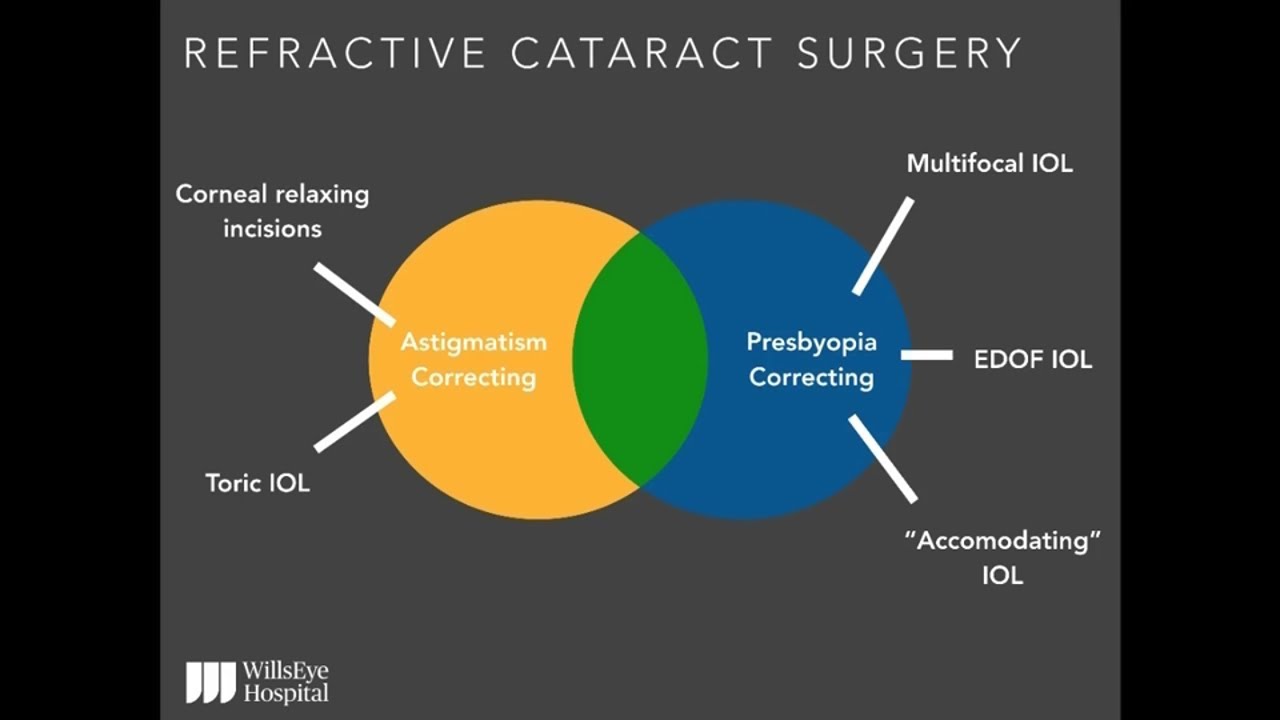 Unlocking Success to Refractive Cataract Surgery