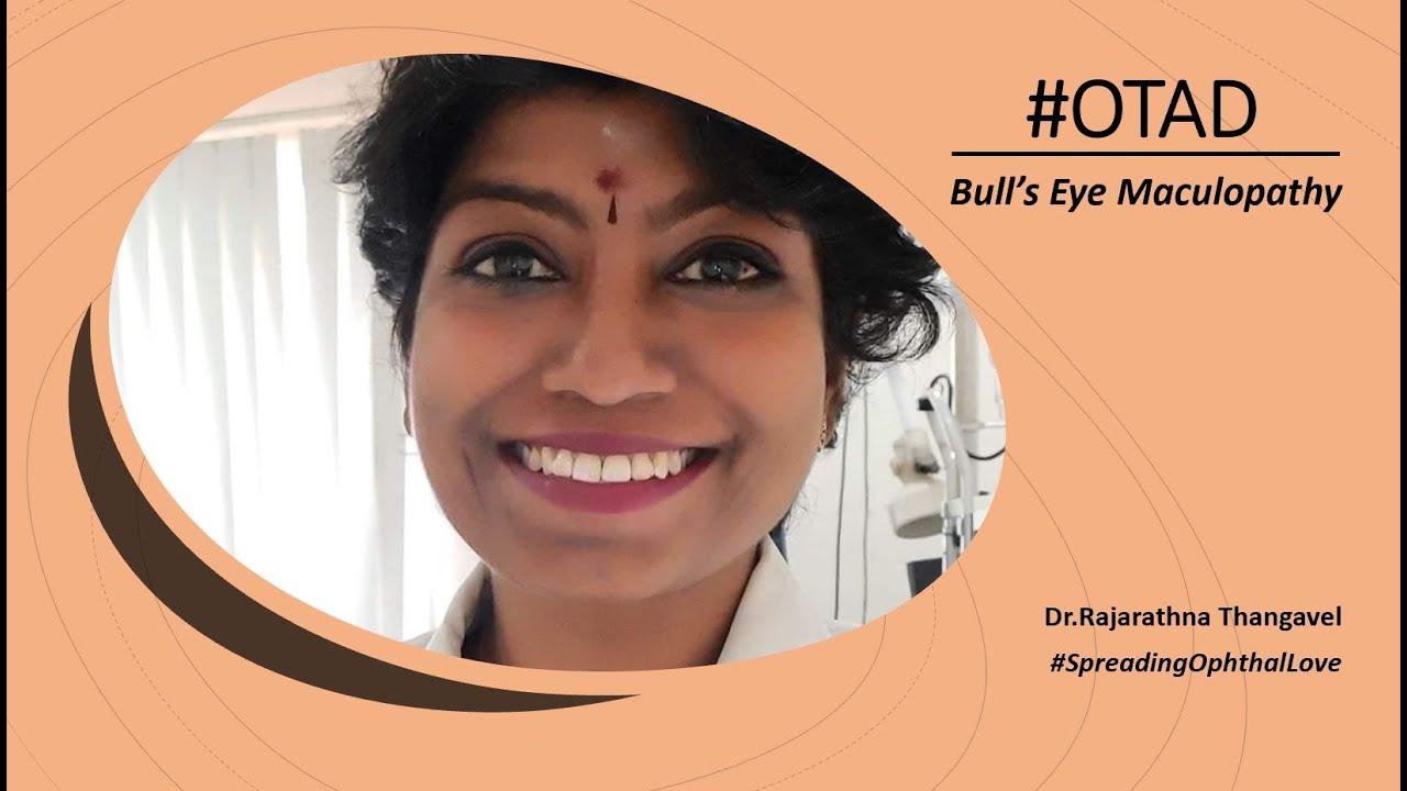 #OTAD - OneTopicADay - Retina - Bull's eye maculopathy with Dr.Rajarathna
