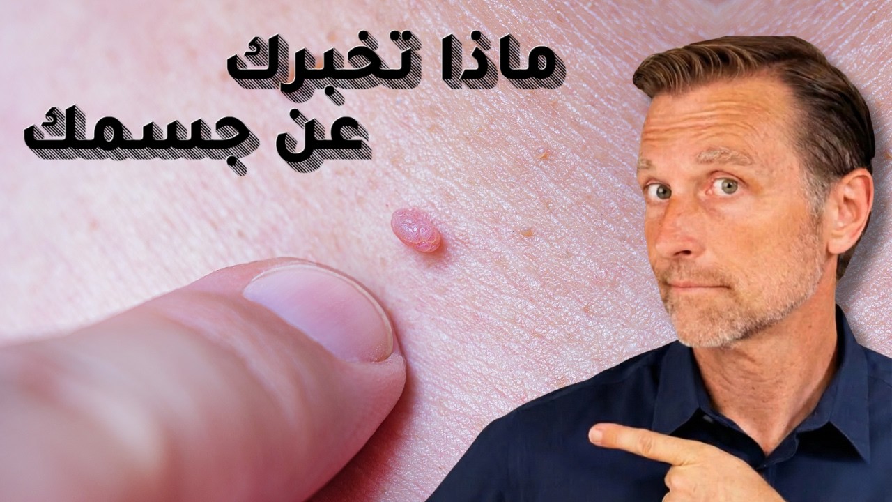 تخلص من السنطة أو الثالول بليلة واحدة