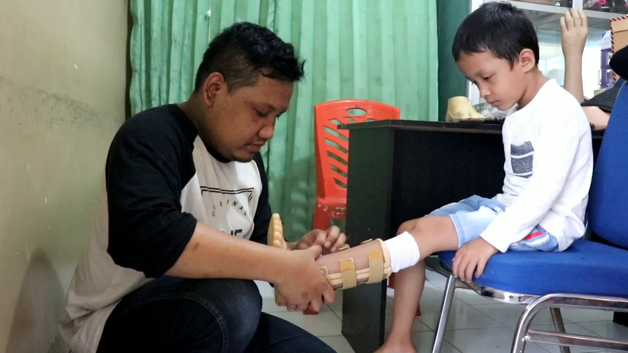 Pemasangan Kaki Palsu Ananda Gifari